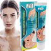ZB Powerful Cream Treatment for Vitiligo and Skin Discoloration Reduce White Spots, Improve Skin Pigmentation