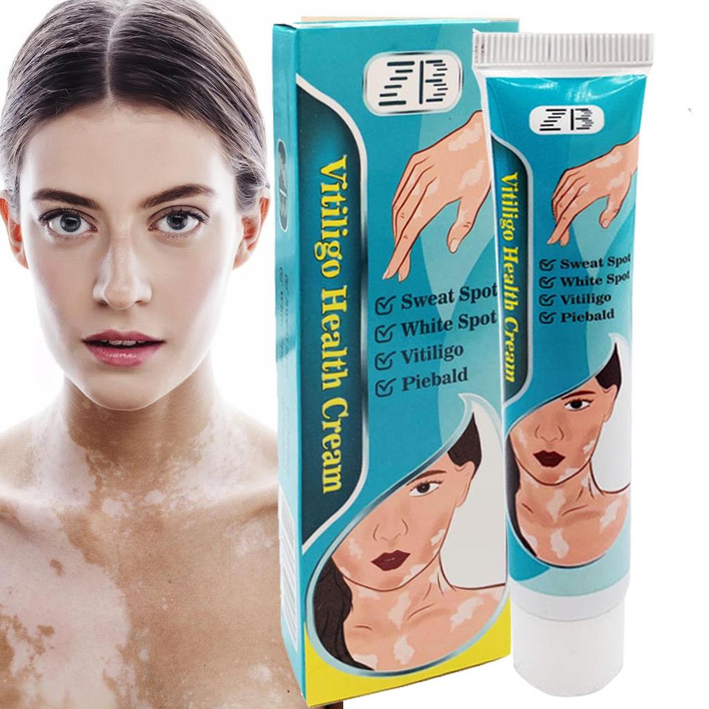ZB Powerful Cream Treatment for Vitiligo and Skin Discoloration Reduce White Spots, Improve Skin Pigmentation