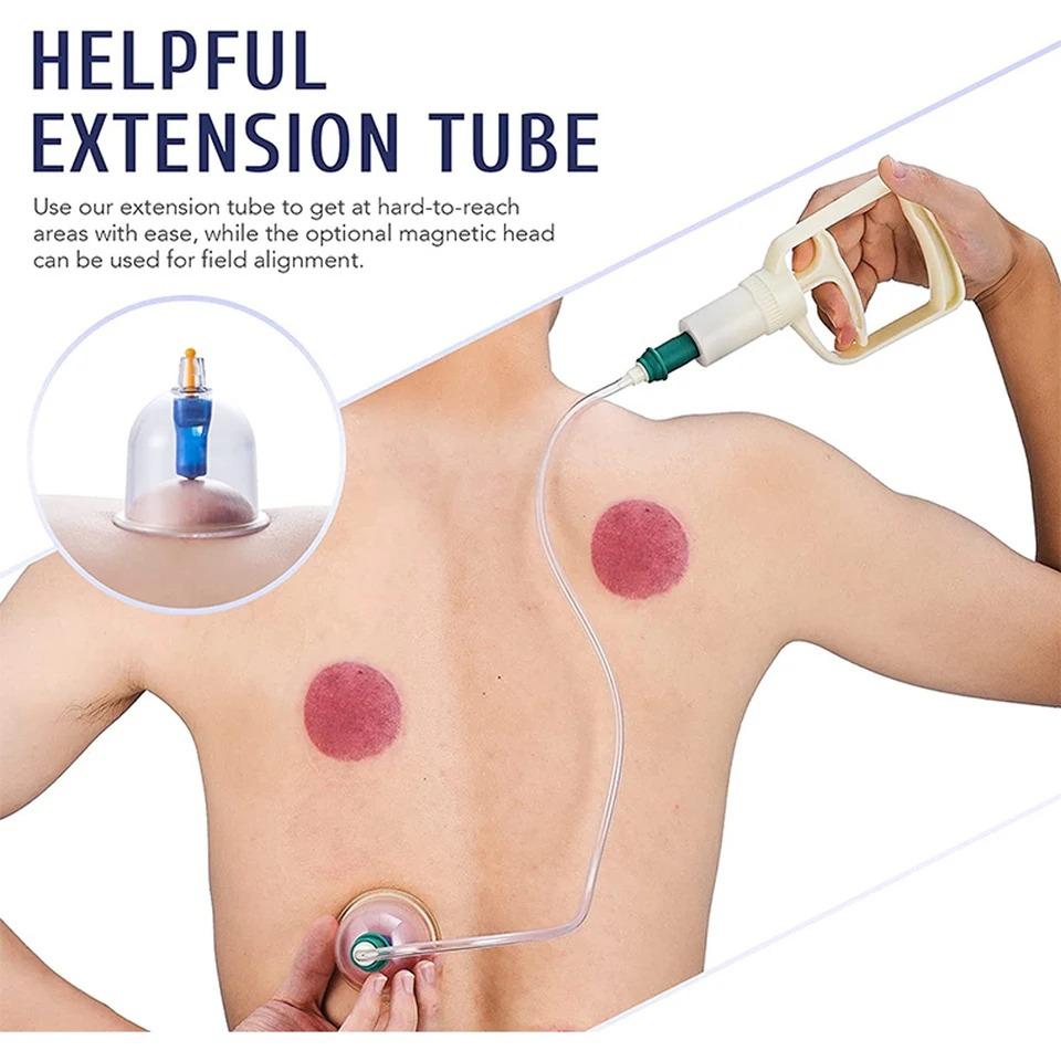 Cupping Device 12Pcs Set Vacuum Cupping For Therapy Body Massager with Magnetic Therapy Head