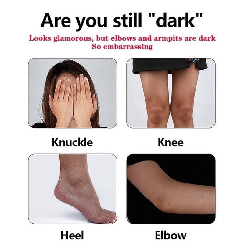 Dark Spot Corrector Massage Cream Joints and Underarm Elbow Whitening Cream