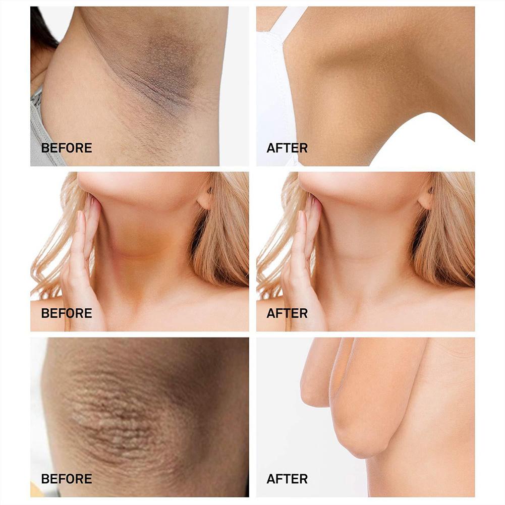 Крем для подмышек. Осветлить подмышки крем. Сандаловая паста для подмышек. Осветляющий крем для кожи подмышек. Обесцвечивание волос на подмышках.