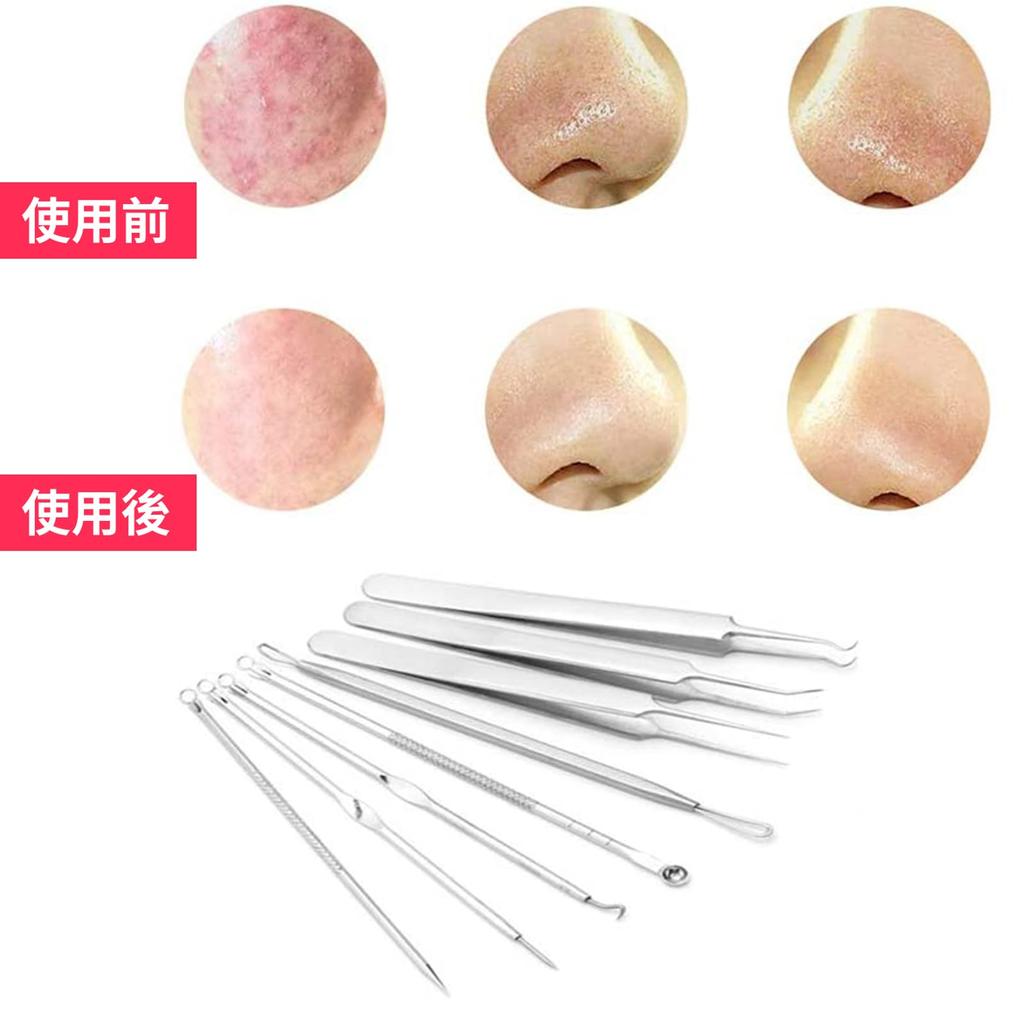 Doyime Precision Tweezers for Blackheads of with Universal Tweezers for Hair Acne Nose Pore Stainless Includes Storage Silver (Set 8) 0.1mm Tips,