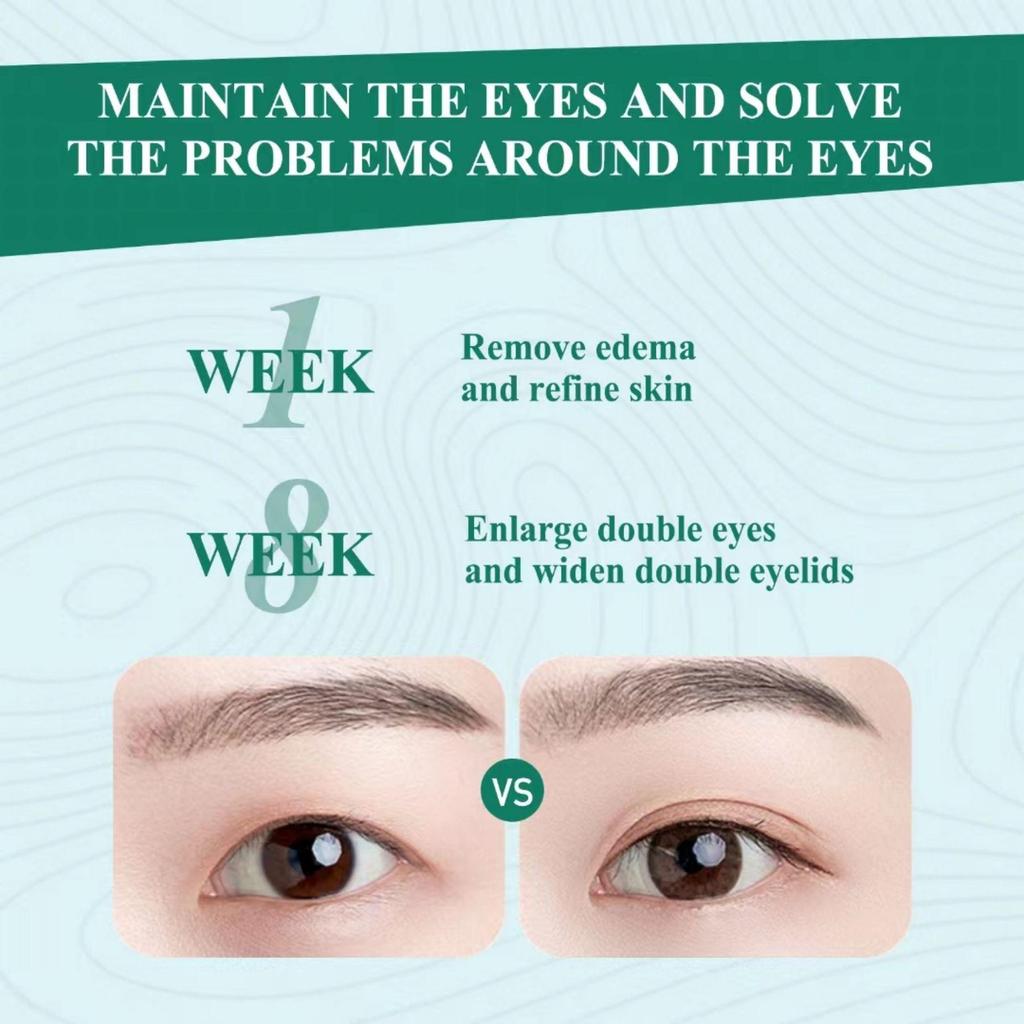 5ML/15ML/30ML/50ML/Retinol Serum pod oczy Usuwa cienie pod oczami Worki pod oczami Liftingujący Rozjaśniający krem pod oczy Kwas hialuronowy Przeciwzmarszczkowy