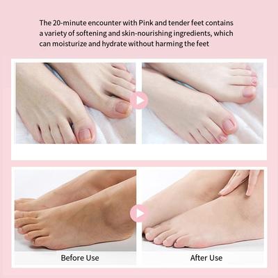 1pair Niacinamide Foot Mask Foot Mask Moisturizing and Rejuvenating Skin Leg Mask Cat Claw Foot Mask