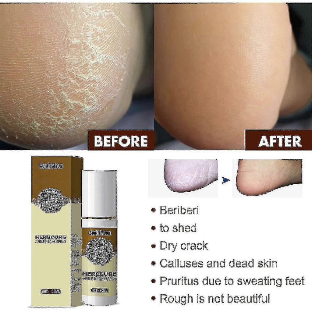 South Moon Herbal Foot Spray Foot Sweat and Odor Care Spray Foot Deodorizing and Dehumidifying Spray