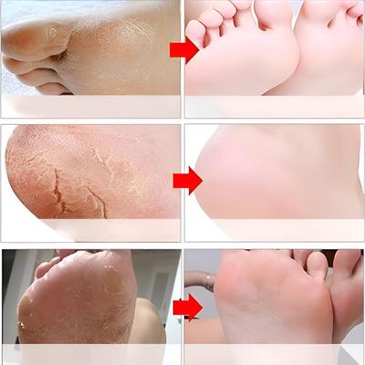 El ve Ayak Bakımı Ürünleri – Ayak Losyonları ve Maskeleri