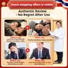 Snoring root special anti-snoring sticker for men and women snoring