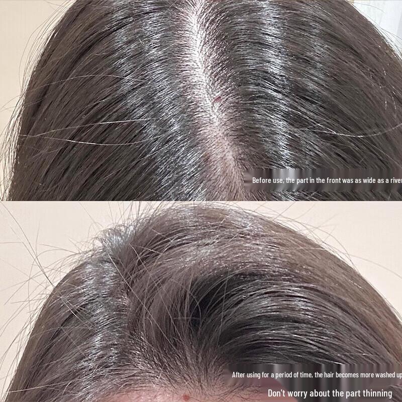 Seeyoung Ginger Anti-Hair Loss Shampoo