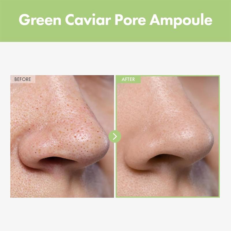 TOSOWOONG Green Caviar Pore Ampulle 33ml