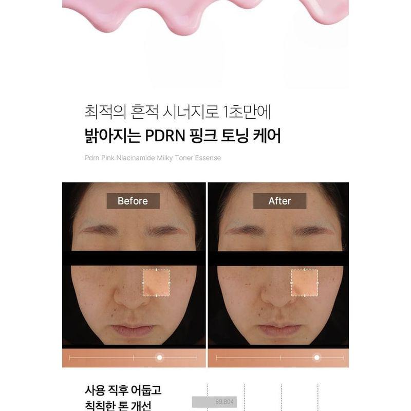 medicube - PDRN Pink Niacinamide Milky Toner