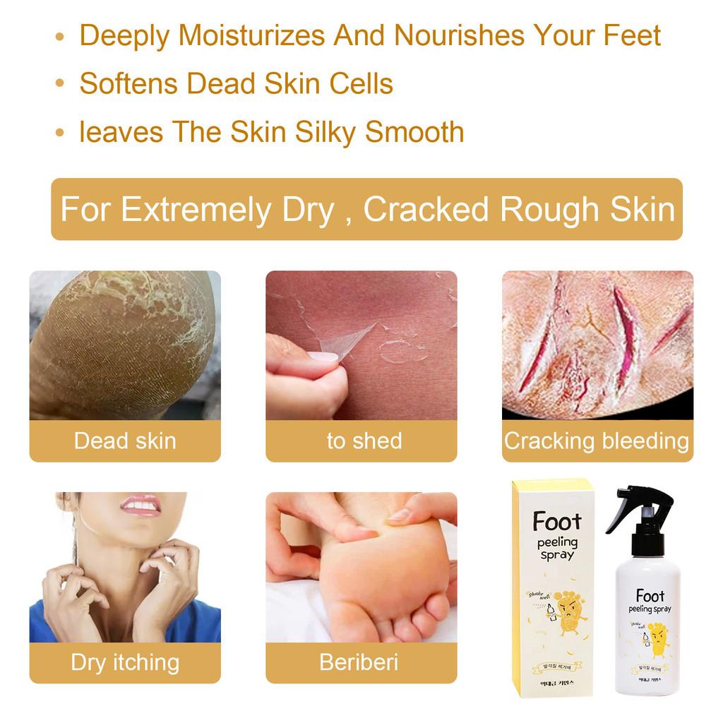 South Moon Exfoliating Foot Brightening Spray Nourishing 200ml Foot Peel