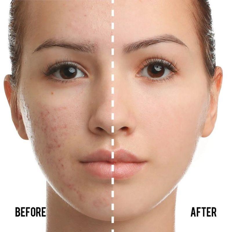 CATKIN - Summer Palace BB Moisture Cover BB Cream Cushion Foundation Set (#C02 Ivory)