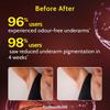 Chemist at Play UnderArm Roll-On with 5% AHA, Lactic Acid & 1% Mandelic Acid | Prevents Body Odour, Alcohol Free-40ml