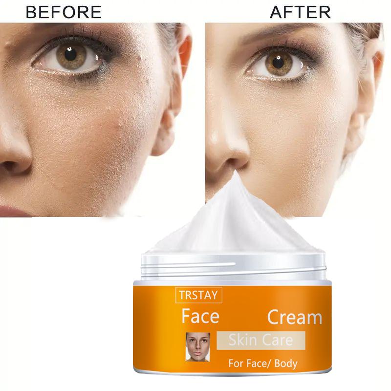 The Moisturizing Cream Replenishes Moisture, Relieves Dryness, Protects Skin Damage, Balances Water and Oil, and Leaves the Skin Delicate and Smooth.