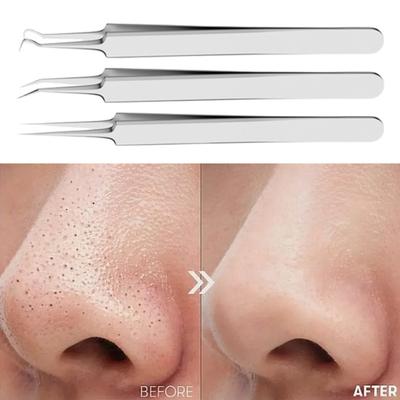 Strumento per la rimozione dei punti neri, pinzette in acciaio inox per l'acne, per una pelle pulita, pinzette per la rimozione dei punti neri, impugnatura antiscivolo, strumento per l'estrazione dell'acne