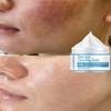 Whitening Freckles Cream Remove Melasma Dark Spot Lightening Melanin Brightening Melasma Remover Moisturize Anti-aging Face Care