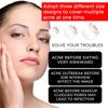 Acne Pimple Patch Repair Facial Acne Acne Cover Acne Smooth Skin Care Pimple Patch Mild Non-Irritating Skin