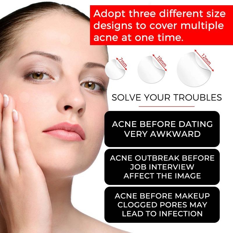 Acne Pimple Patch Repair Facial Acne Acne Cover Acne Smooth Skin Care Pimple Patch Mild Non-Irritating Skin