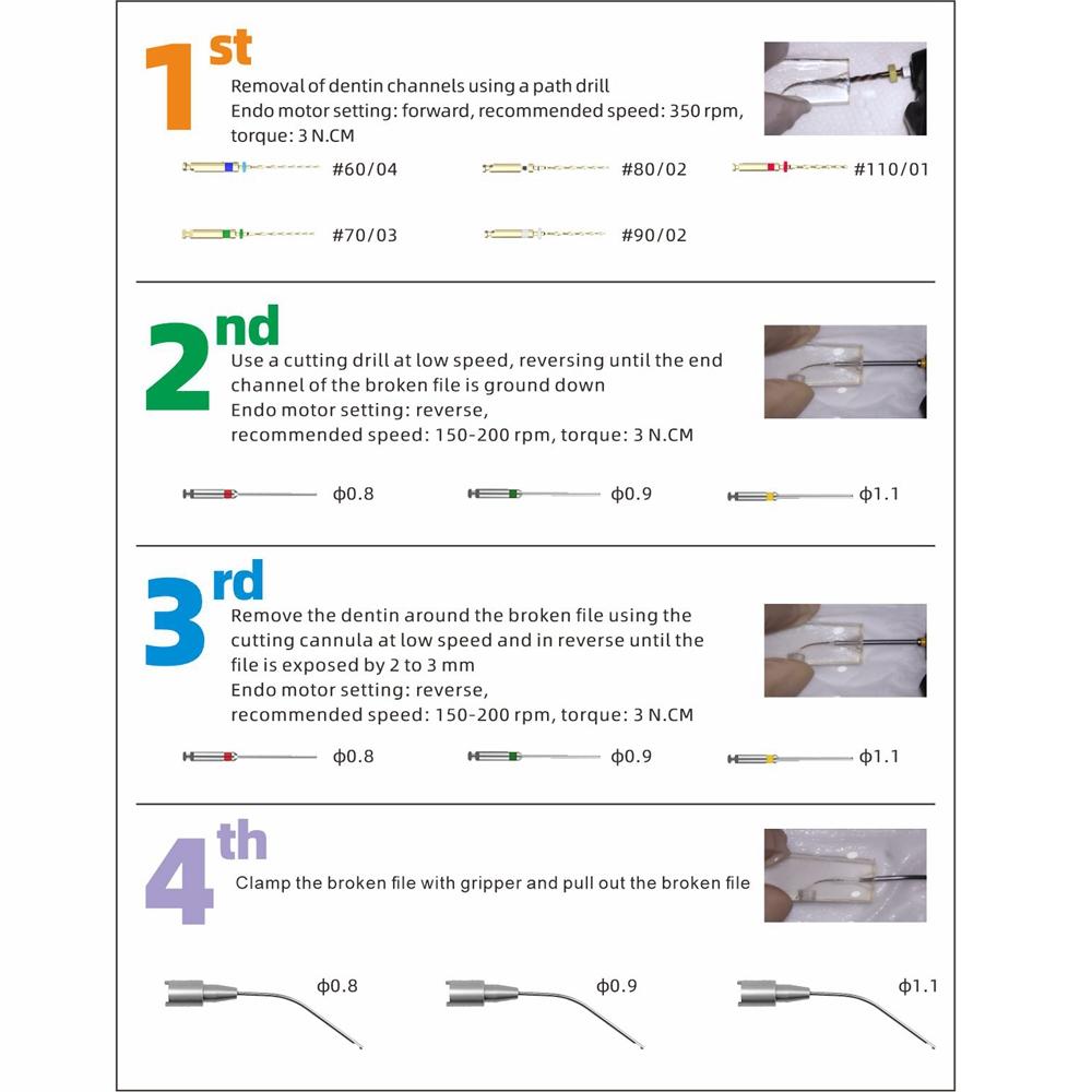 Dentalt Endodontiskt Endo Filsborttagningssystem Kit Endo Bruten Fil Borttagningsinstrument Set Rotkanal Filsxtraktor För Klinik