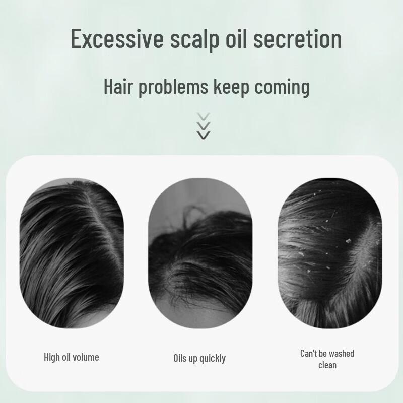 Shilang Ginger Anti-Dandruff Repair Shampoo