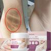 Aufhellungscreme für dunkle Haut Achselaufhellung Achselaufhellung und Intimbereich Frau Feuchtigkeitscreme Koreanische Hautpflegeprodukte