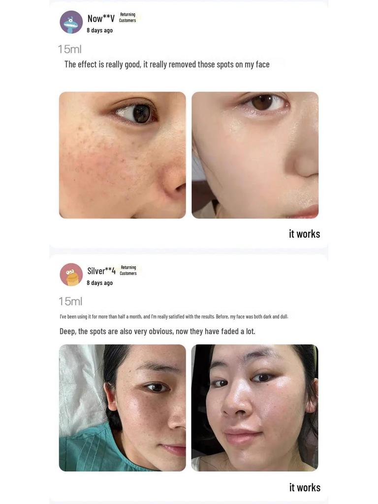 Han Bei Dan White Oil - Whitening & Freckle Removal Essence