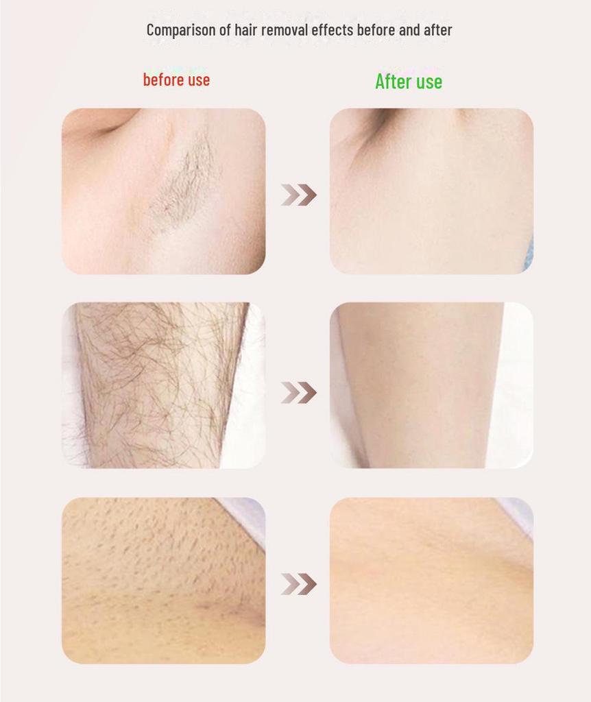 Women's Electric Shaver for Lip, Armpit, Leg, and Pubic Hair Removal