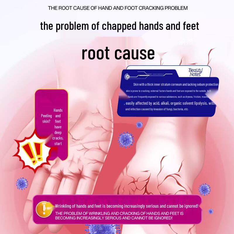 BEAUTY NOTES Anti-Crack Foot & Hand Repair Cream