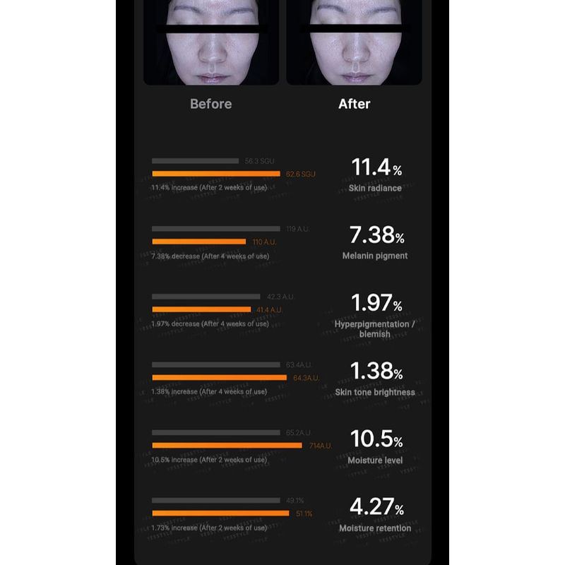 medicube - AGE-R Booster Pro Pink Edition