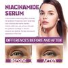 20% Niacinamide B3 Concentrated Skincare Anti Aging Color Removal Pore  Shrinking Spot Fading Wrinkles and Wrinkles 20ml