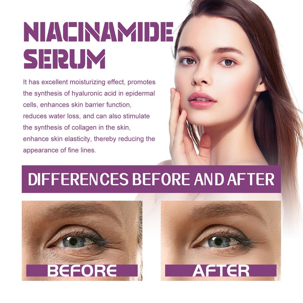 20% Niacinamide B3 Concentrated Skincare Anti Aging Color Removal Pore  Shrinking Spot Fading Wrinkles and Wrinkles 20ml
