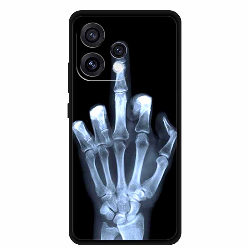 For Oppo Reno15 5G Case 6.59" Cute Cat Balck Edge Soft Silicone Wolf Phone Back Cover For Oppo Reno 15c 5G Protective Lion Funda