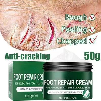 Crema nutritiva antigrietas para tratamiento de olores, productos para el cuidado de la piel, producto para eliminar la piel muerta, crema reparadora agrietada, 2021