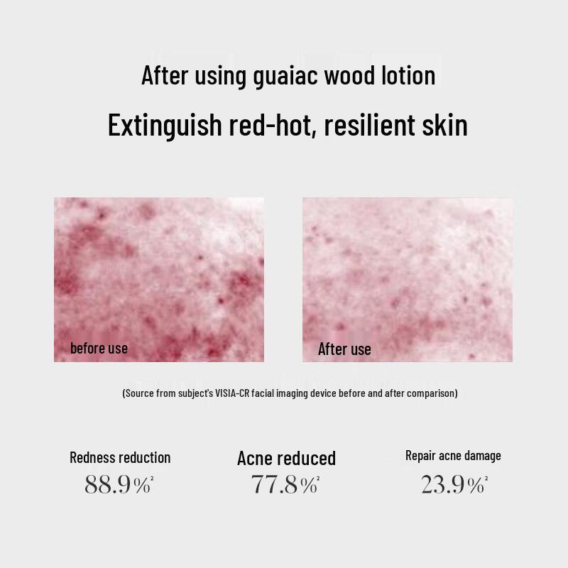 SEEK & CARE Guaiac Wood Anti-Acne Repair Lotion 100ml