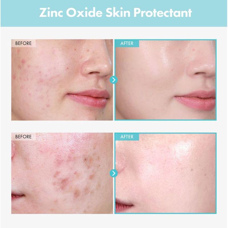 TOSOWOONG SOS Repair Cica Clinic Zinc Oxide 10% Cream 50g