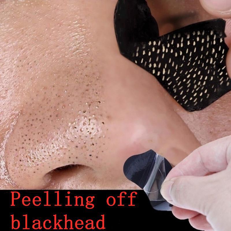 Blackhead & Acne Removal Nose Mask - Available In 5, 10, 15, or 20 Pieces