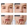 ANLAN - 2 In 1 EMS Eye Beauty Device