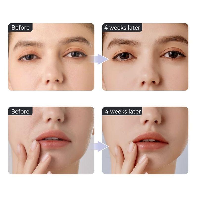 ANLAN - 2 In 1 EMS Eye Beauty Device