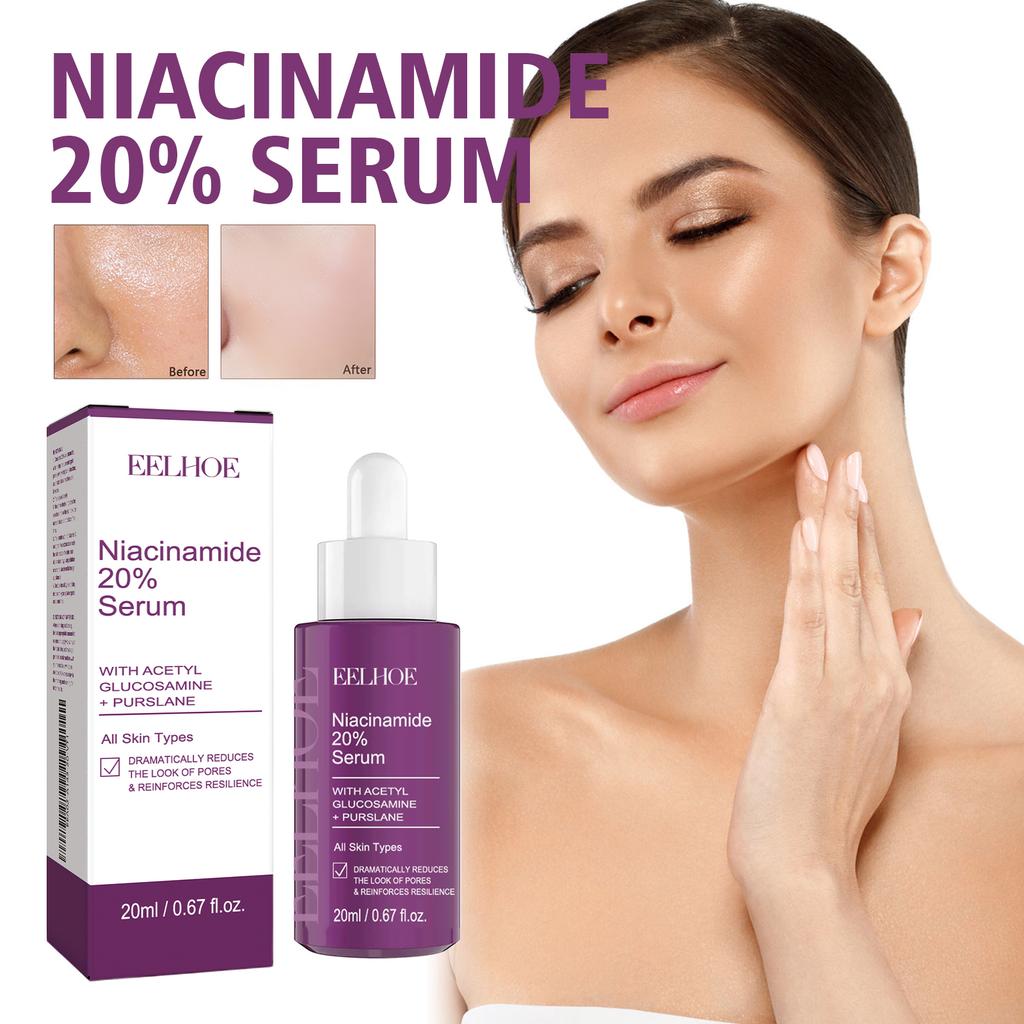 Siero alla Niacinamide 20ml Schiarisce il Tono della Pelle Riduce le Macchie Scure Minimizza i Pori Anti-Age Idratante Skincare
