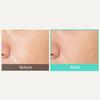 OBgE Pore Zero Oil Control Sun Stick SPF50+ PA++++ 18g