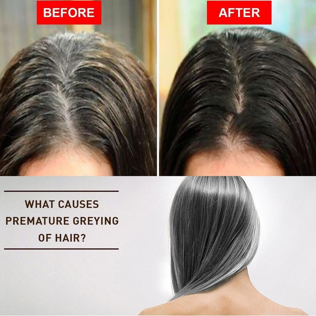 Spray pour cheveux blancs, fonçage naturel des cheveux, nutriments capillaires biologiques, favorise des cheveux plus lisses 50 ml
