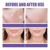 Dark Spot Correcting Patches Freckles Remover Brightening Fade Fade Dark Spots Lightening Melasma Facial Invisible Care Stickers