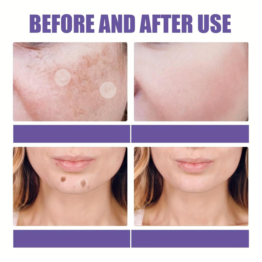 Dark Spot Correcting Patches Freckles Remover Brightening Fade Fade Dark Spots Lightening Melasma Facial Invisible Care Stickers