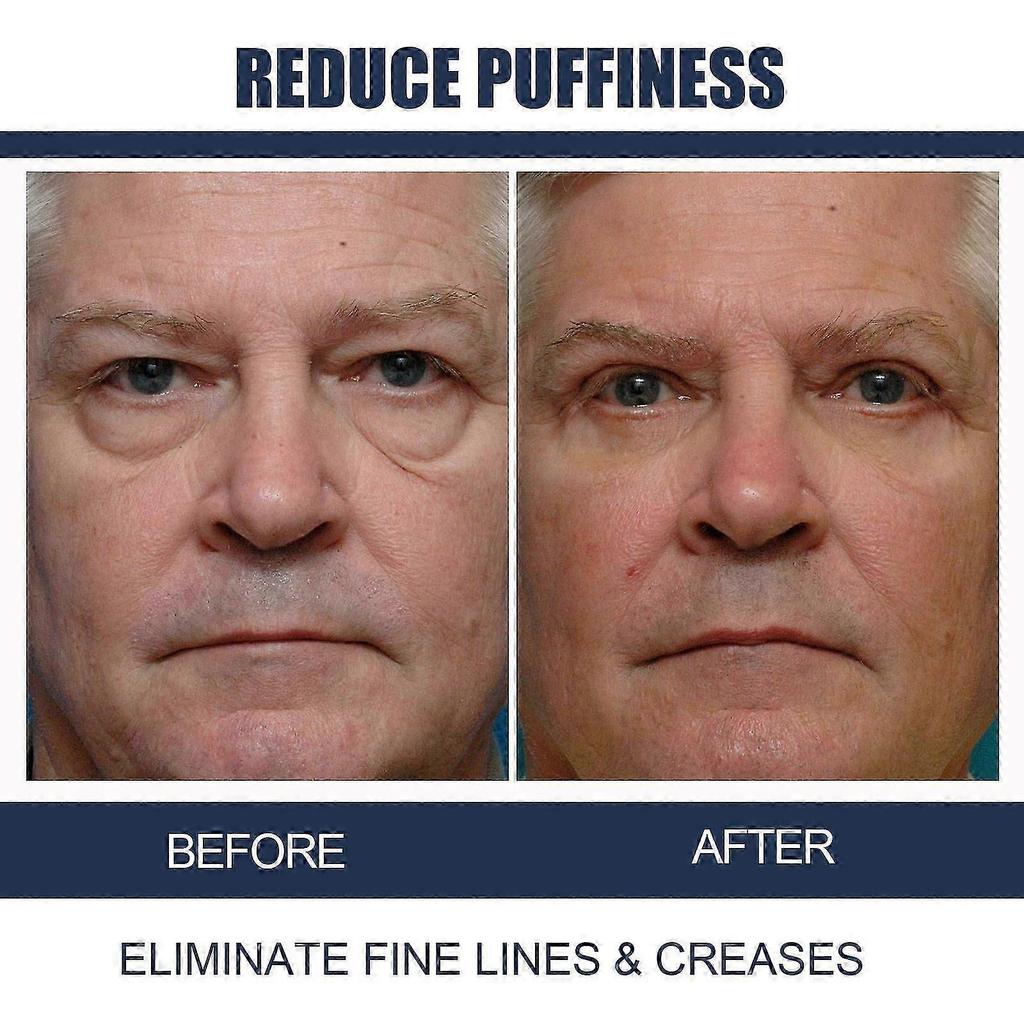 3pcs Anti-Aging Eye Cream Lighten Eye Lines Repair Eye Bags Dark Circles Hydration Firming Eye Cream