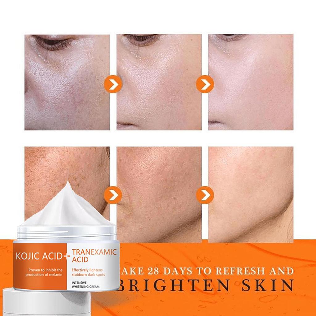 Scar Removing and Whitening Essence Cream Protects the Damaged Skin On the Face, Brightens Skin Tone, Anti-aging Nourishing Moisturizer