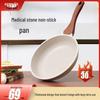Yike Wei Non-stick Maifan Stone Frying Pan for Home – Ideal for Pancakes, Steaks, and Works with Induction Cookers.