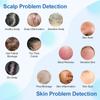 Portable Hair Follicle Scalp Detector 4X Magnifying Pore Magnifier Facial Skin Tester Analyzer Hair Scalp Diagnostic Machine