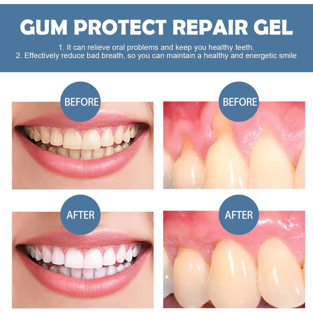 EELHOE Gum & Tooth Stain Repair Gel for Fresh Breath & Deep Cleaning