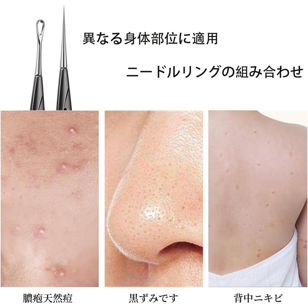 Lyyxjsltd Acne Clean and Acne Patch Blackhead Blackhead Beauty Pore Acne Beauty Tool Needles, 2-Pack, Hygienic, Painless, Non-Scratch, Needles,