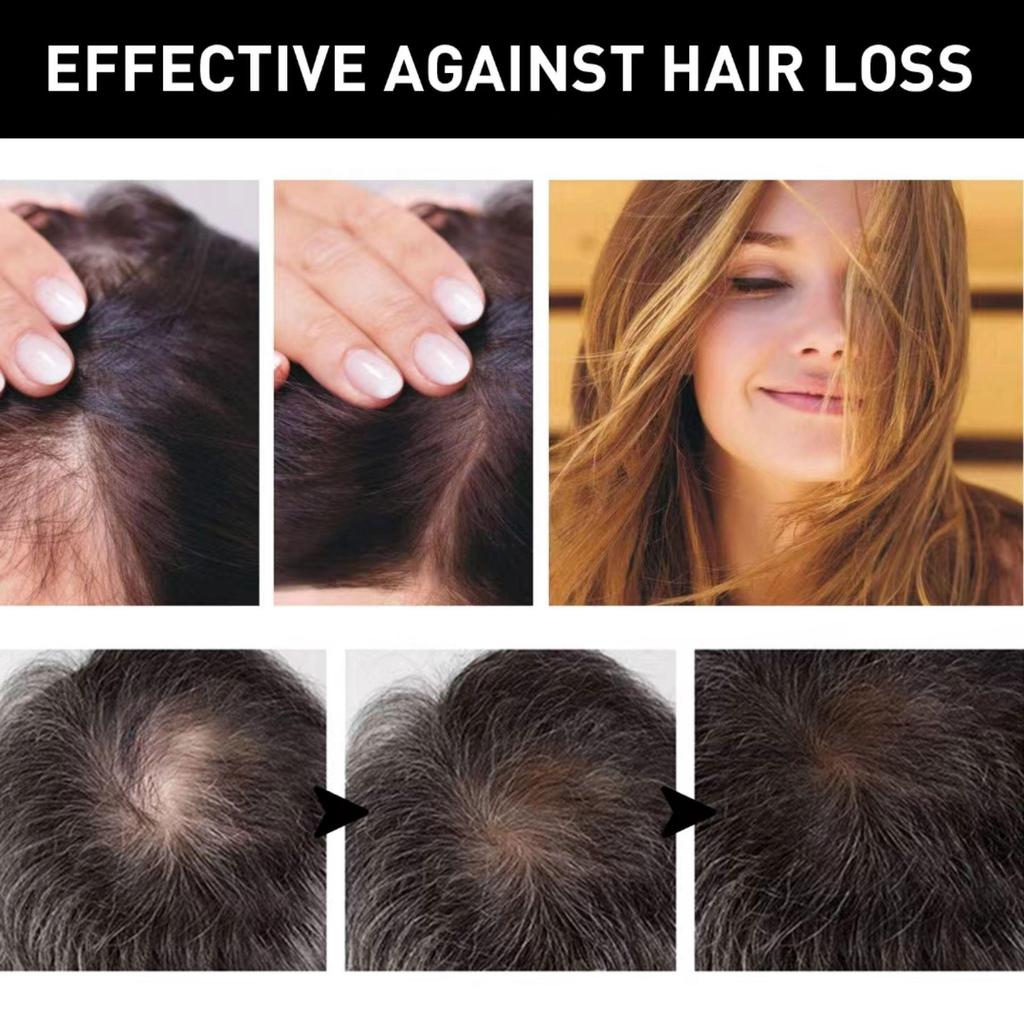 5% Minoxidil Biotin Hair Serum For Men And Women Dense Hair Serum Healthy Hair Penetrates Root To Tip